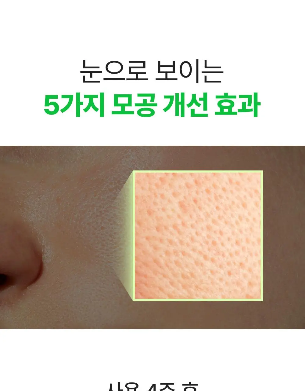 [7월올영픽/곰돌이푸콜라보] 성분에디터 그린토마토 NMN 포어 리프팅 앰플 40ml 더블 기획 (+히퍼 랜덤 1종) 상세페이지 28